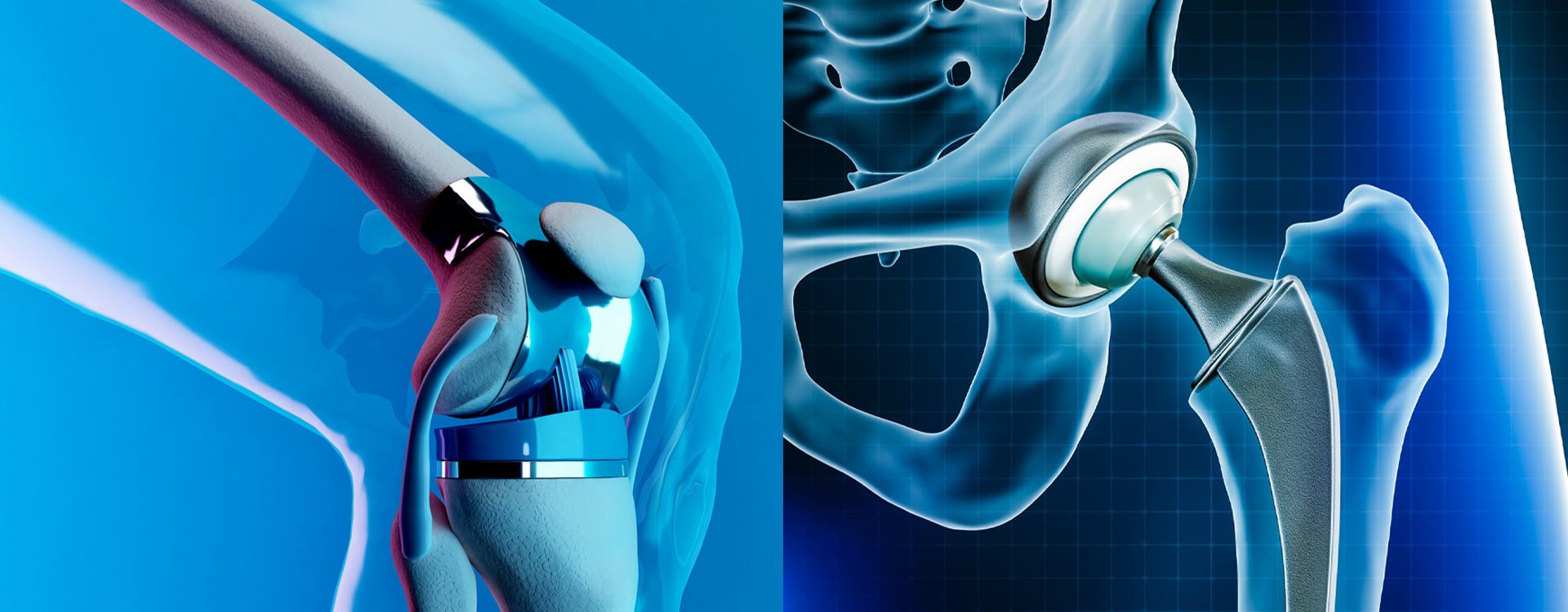 August-Same-Day-Total-Joint-Surgery-Blog-Image-1920x750